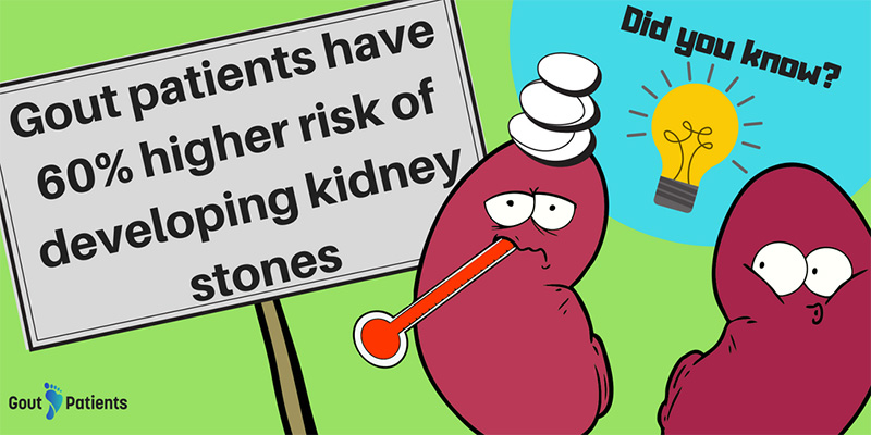 Gout patients have 60% higher risk of developing kidney stones