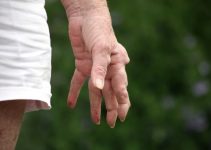 Rheumatoid Arthritis Nodules – Risk Factors, Diagnosis, Treatment
