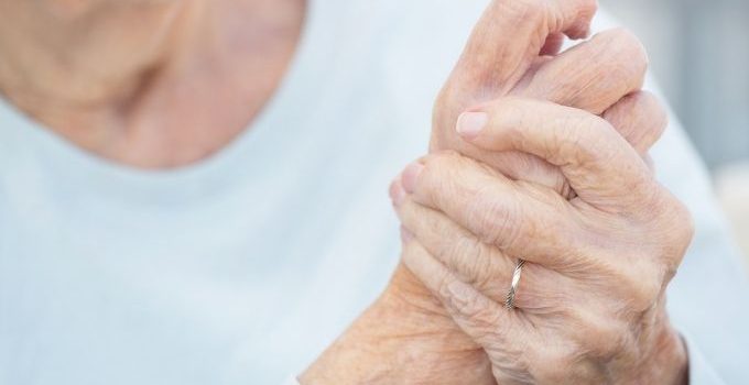 arthritis vs arthralgia