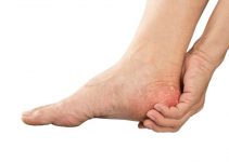 Gout in Heel – What Are the Symptoms and Treatments?