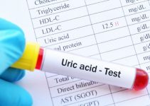 How to Reduce Uric Acid
