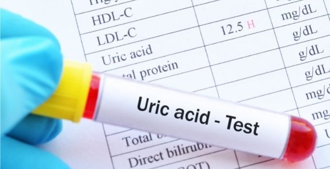 How to Reduce Uric Acid