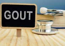 What Is the Fastest Way to Get Rid of Gout?