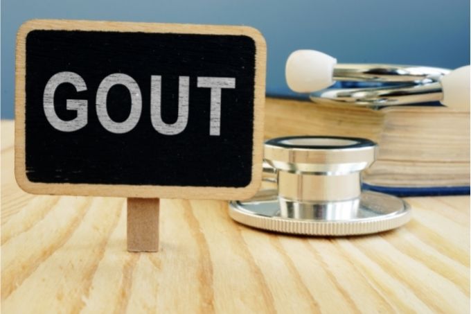What Is the Fastest Way to Get Rid of Gout