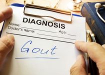 How is Gout Diagnosed – The List of 6 Techniques